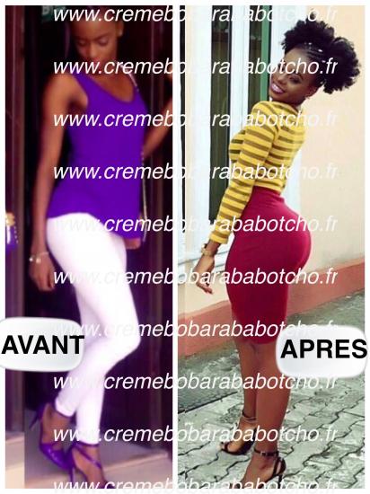 GROSSIR DES FESSES RAPIDEMENTS, creme botcho, pommade botcho , creme bobaraba botcho,  pommade awatoza , grossir des fesses